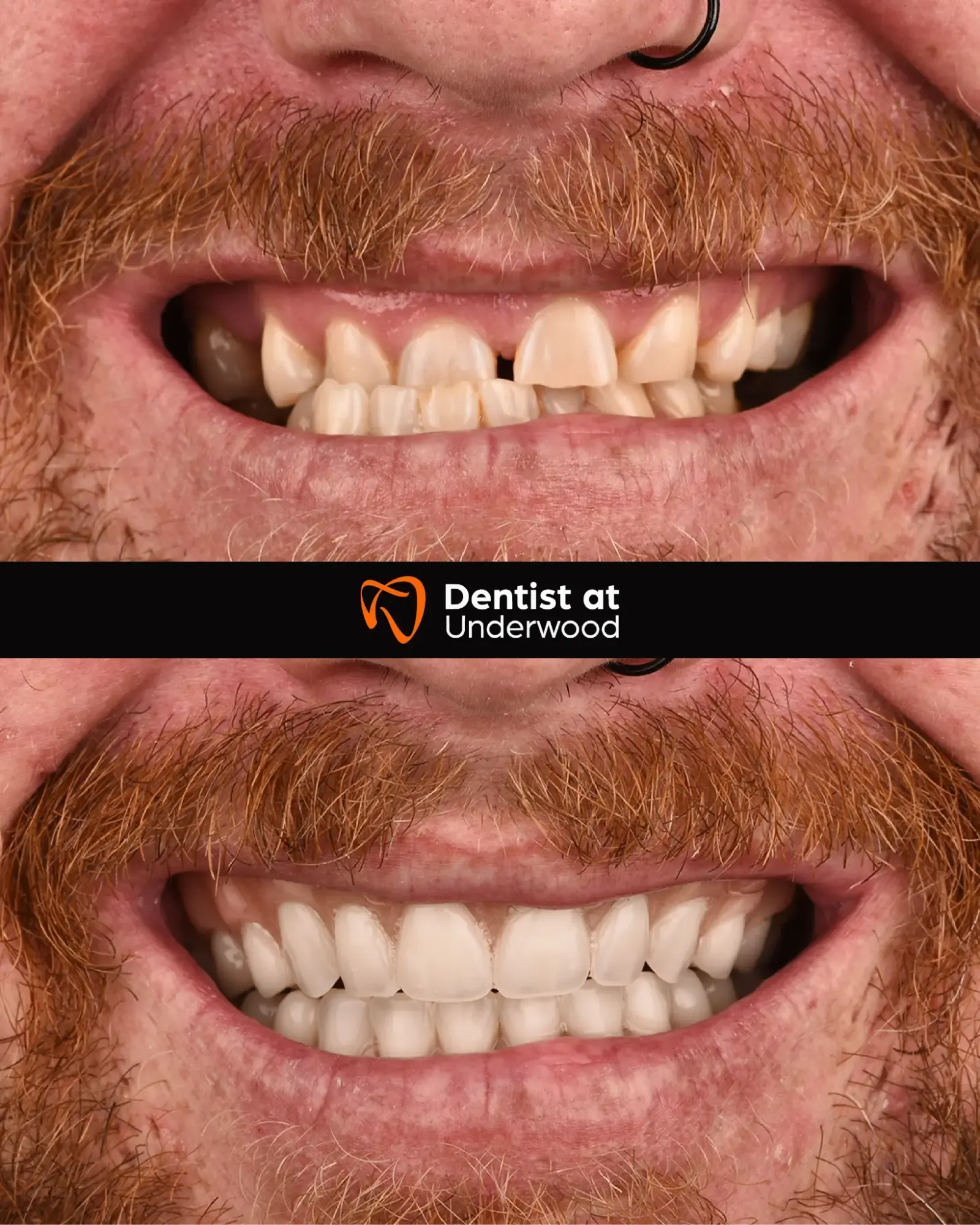 Dental treatment case 3