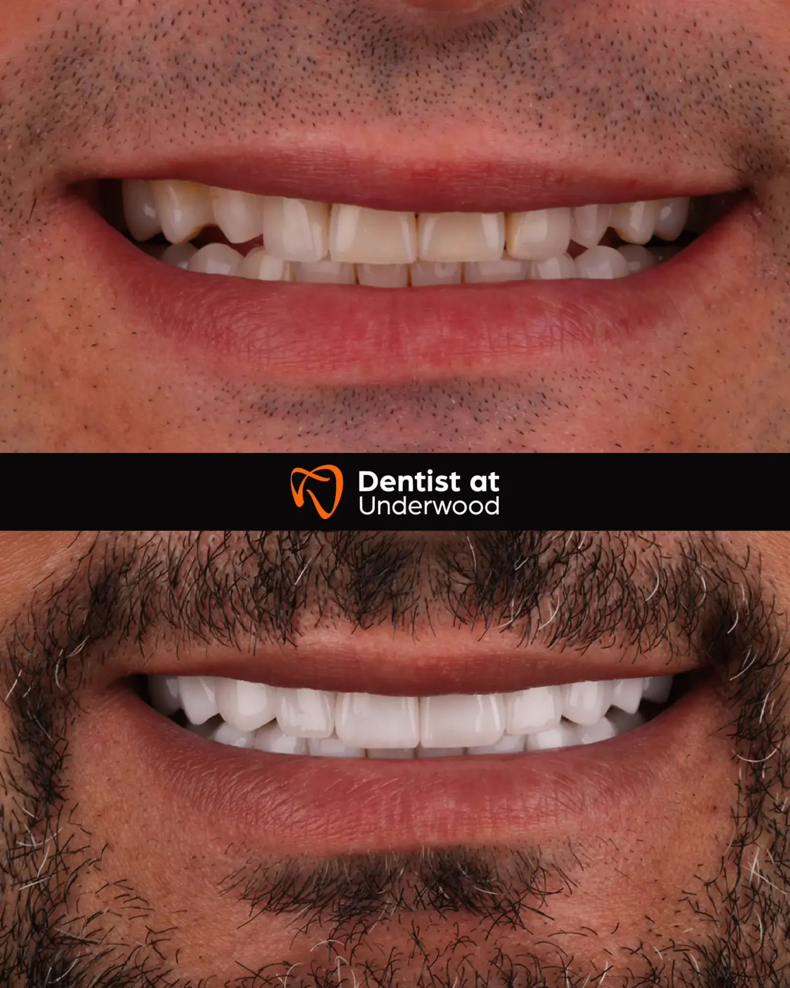 Dental treatment case 7