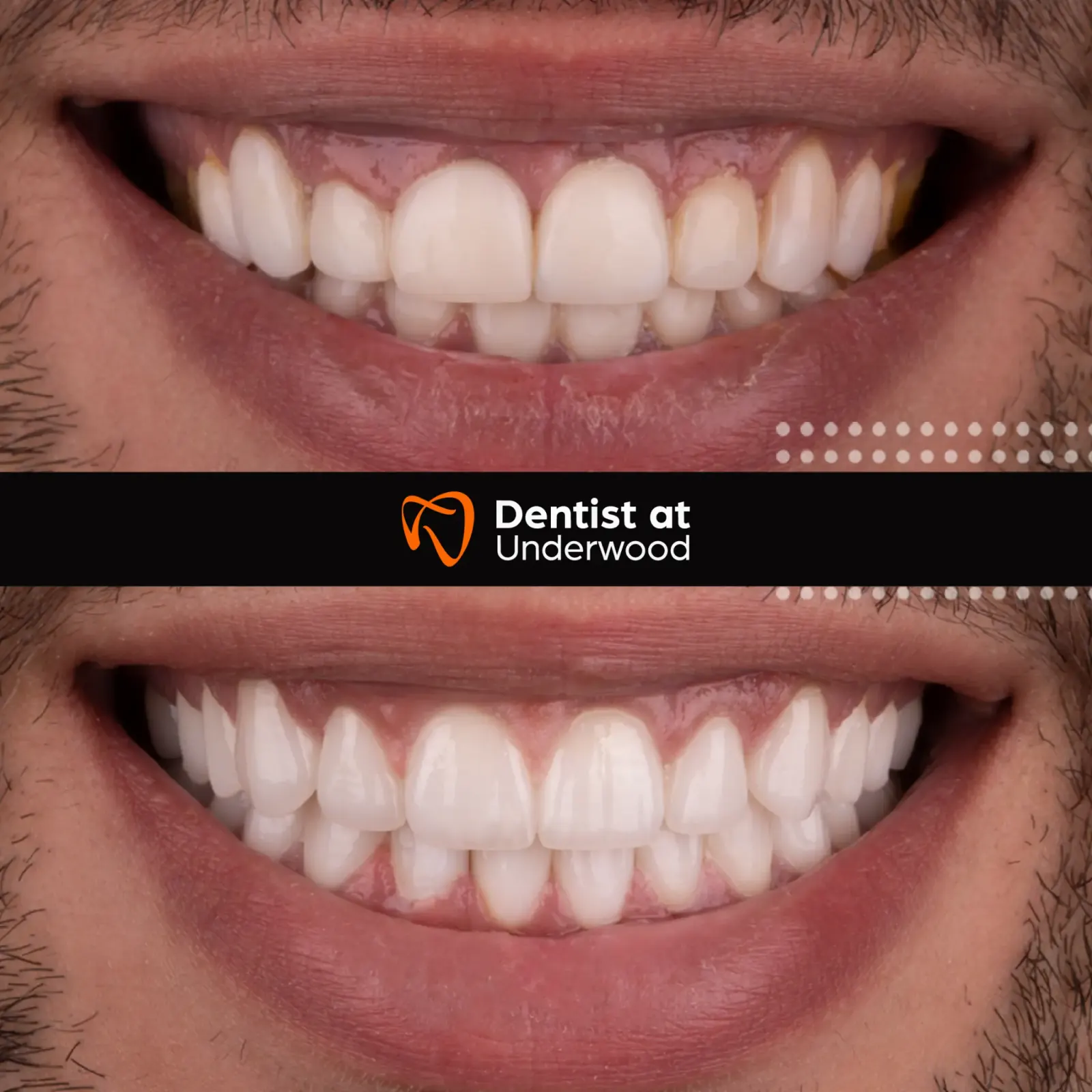 Dental treatment case 9