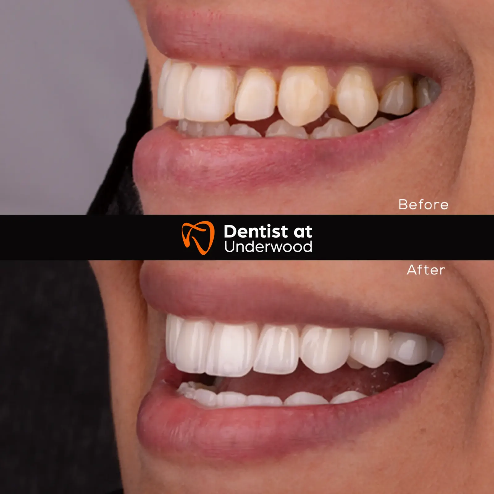 Dental treatment case 12