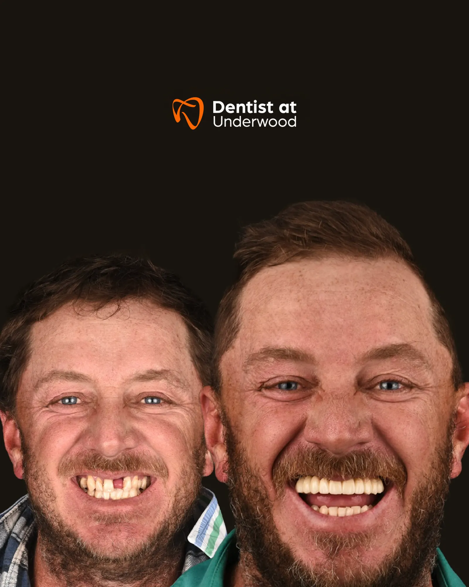 Dental treatment case 18
